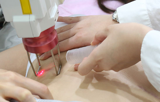 프락셔널 레이저 치료