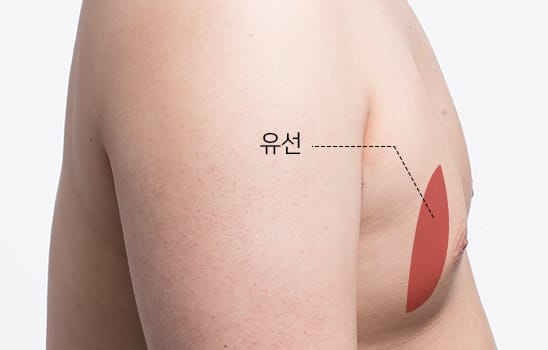 흉터 걱정이 거의 없습니다
