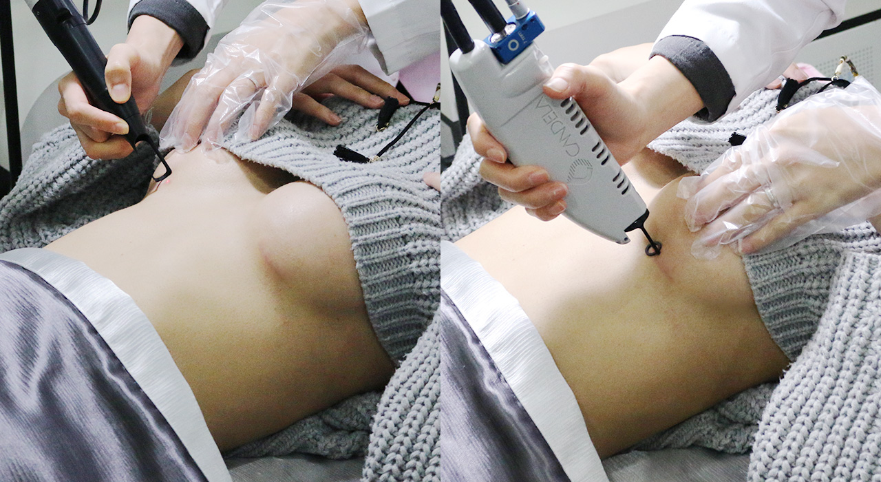 바노바기 피부과 진료 연계 : 힐링 스카 프로젝트