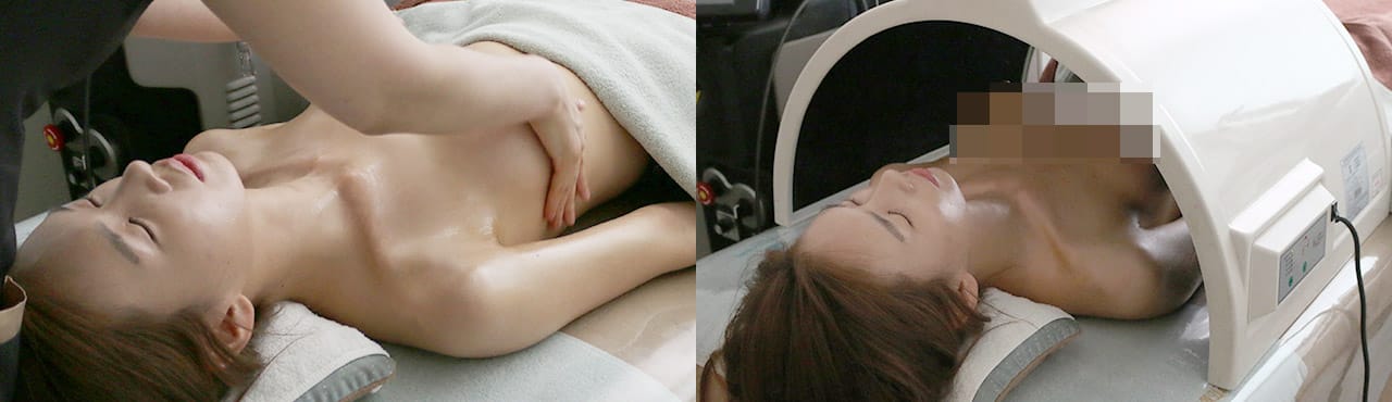 수술 후 체계적인 케어 프로그램 : 관리 및 체크