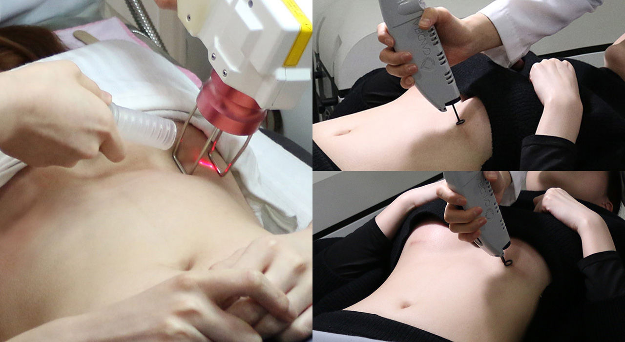 바노바기 피부과 진료 연계 : 힐링 스카 프로젝트