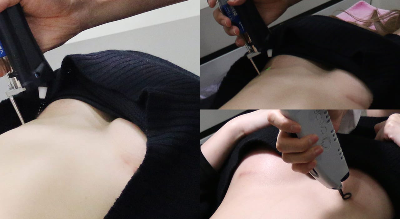 바노바기 피부과 진료 연계 : 힐링 스카 프로젝트