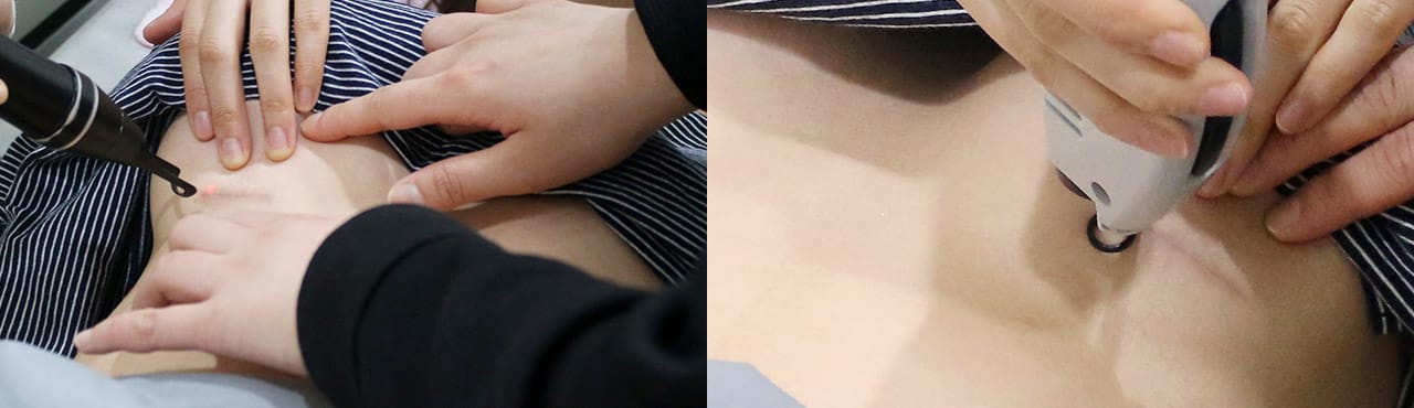 바노바기 피부과 진료 연계 : 힐링 스카 프로젝트